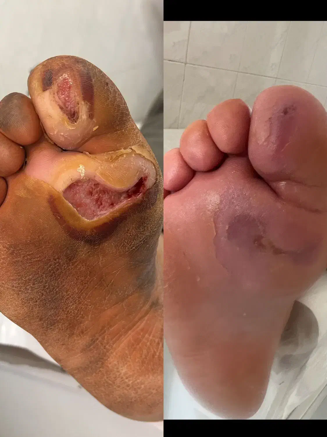 کلینیک تخصصی درمان انواع زخم(بستر و دیابت) فردوس|خدمات آرایشگری و زیبایی|اصفهان, محله سفلی|دیوار