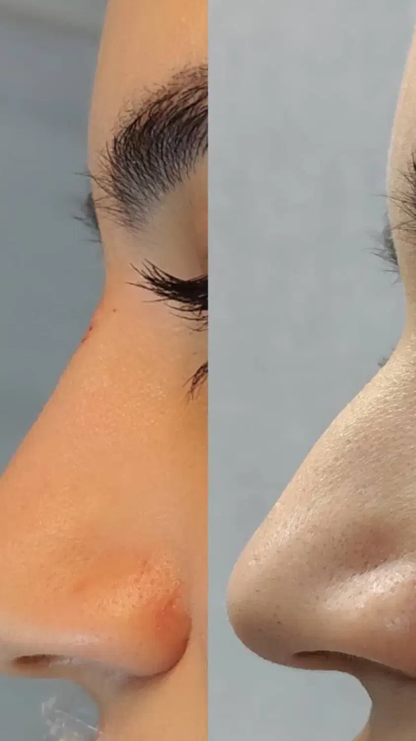 خدمات زیبایی کلینیک فارا دامغان|خدمات آرایشگری و زیبایی|دامغان, |دیوار