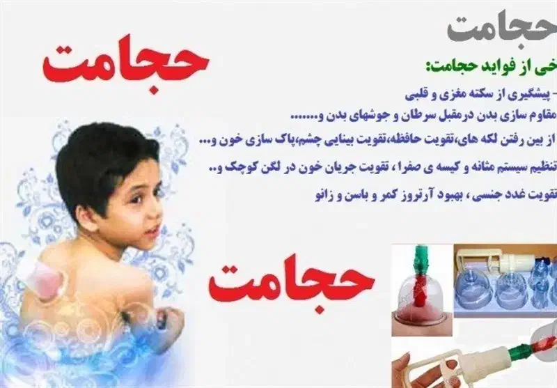 حجامت درمانی و بادکش درمانی|خدمات آرایشگری و زیبایی|اهواز, بهارستان|دیوار