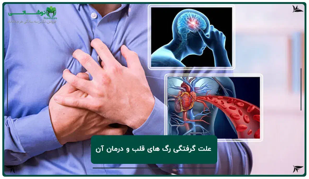 علت گرفتگی رگ قلب|آرایشی، بهداشتی، درمانی|بندر امام خمینی, |دیوار