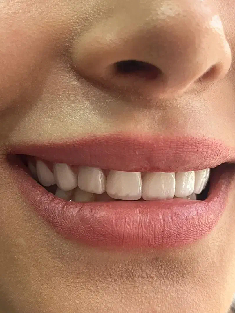 جشنواره پاییژه دندانپزشکی|خدمات آرایشگری و زیبایی|قم, چهار امامزاده|دیوار