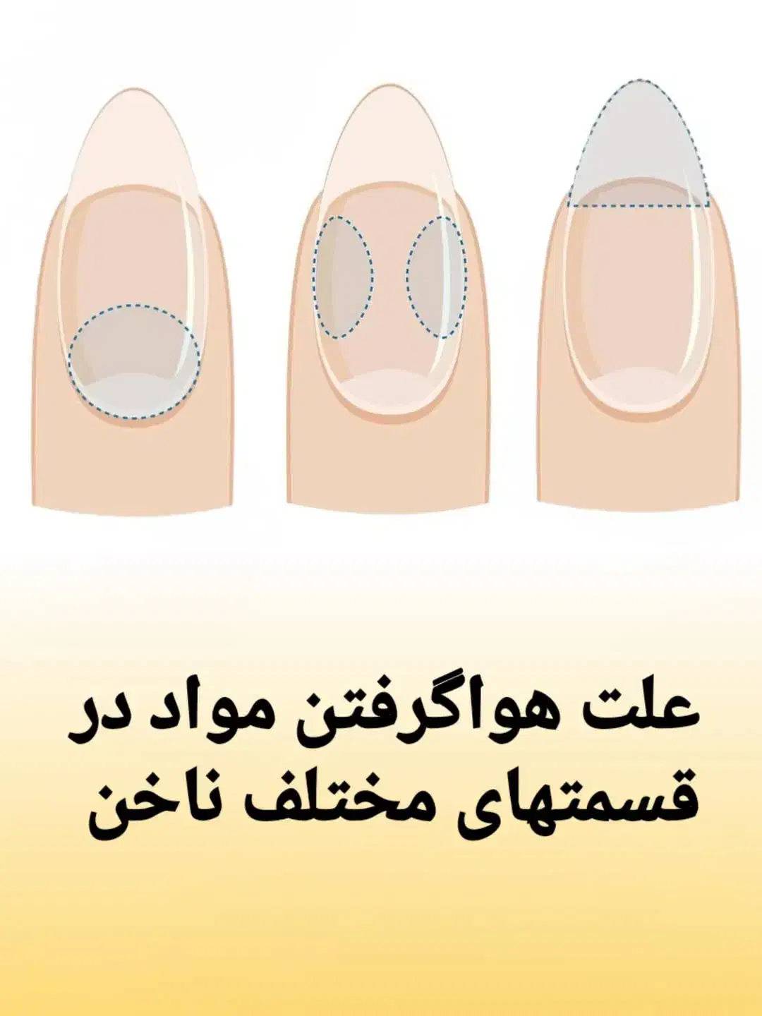 کلاس های اموزشی کاشت ناخن ژل استارت|خدمات آموزشی|مسجد سلیمان, |دیوار