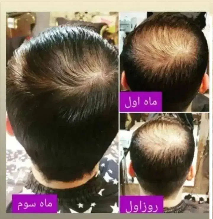 دعوت به مشاوره رایگان|آرایشی، بهداشتی، درمانی|شیراز, ابیوردی|دیوار
