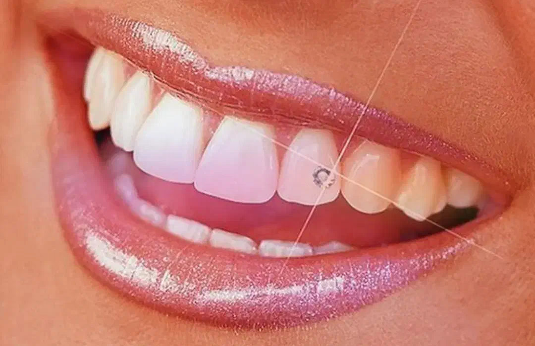 دستیار دندانپزشک|استخدام درمانی، زیبایی، بهداشتی|رشت, گلسار|دیوار