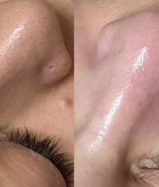 آفر ویژه ی فشیال تخصصی با دستگاه در سالن مهوا|خدمات زیبایی و سلامت|کرمانشاه, |دیوار