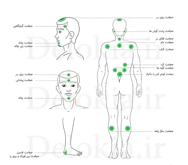 انواع حجامت و بادکش و فصد خون در مطب و در منزل|خدمات آرایشگری و زیبایی|پاکدشت, پاکدشت (مامازند)|دیوار