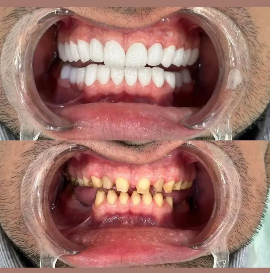 دندان پزشکی|خدمات آرایشگری و زیبایی|کرمانشاه, |دیوار