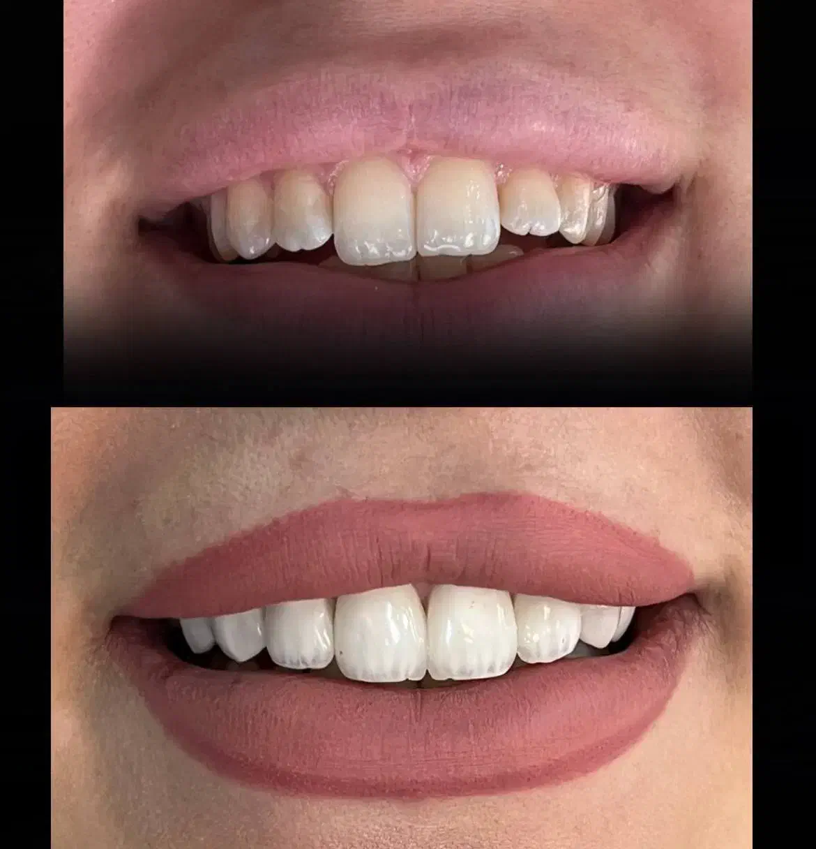 جشنواره دندانپزشکی درمانی و زیبایی|خدمات آرایشگری و زیبایی|تهران, هفت حوض|دیوار