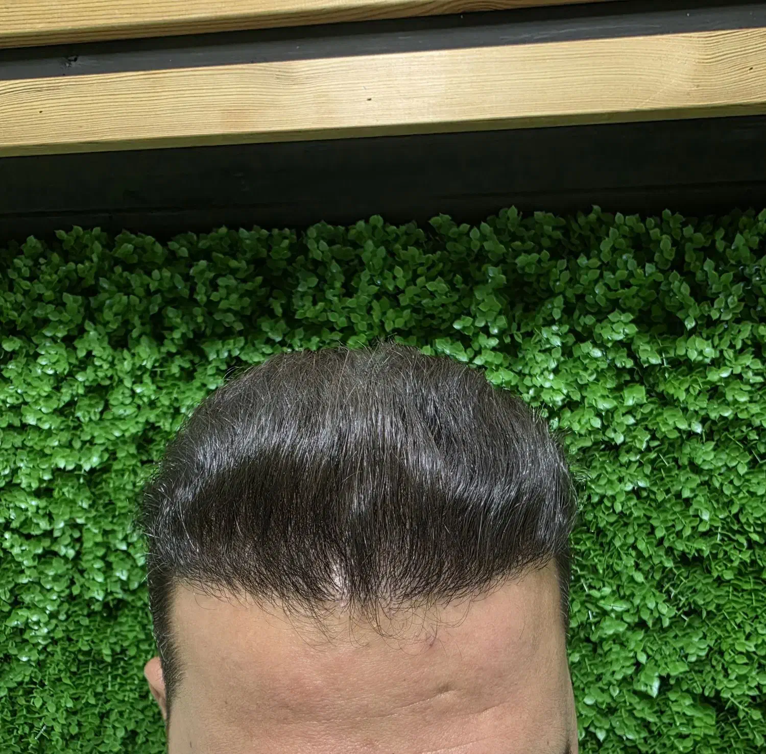 کاشت مو فول تراکم شیرازی|خدمات آرایشگری و زیبایی|نهاوند, |دیوار