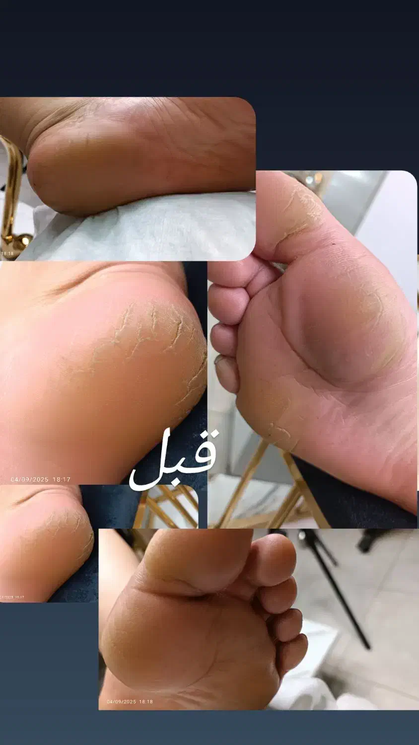 تخفیف ویژه پارافین تراپی دست و پا همراه کف سابی پا|خدمات آرایشگری و زیبایی|یزد, |دیوار