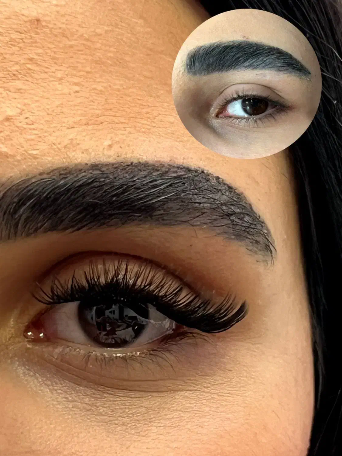 تخفیف بلک فرایدی کاشت هیدن از 180تومن|خدمات آرایشگری و زیبایی|رشت, دیانتی|دیوار