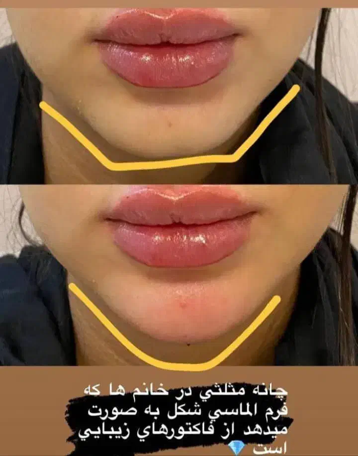 زیبایی|خدمات آرایشگری و زیبایی|محمدشهر, محمدشهر|دیوار