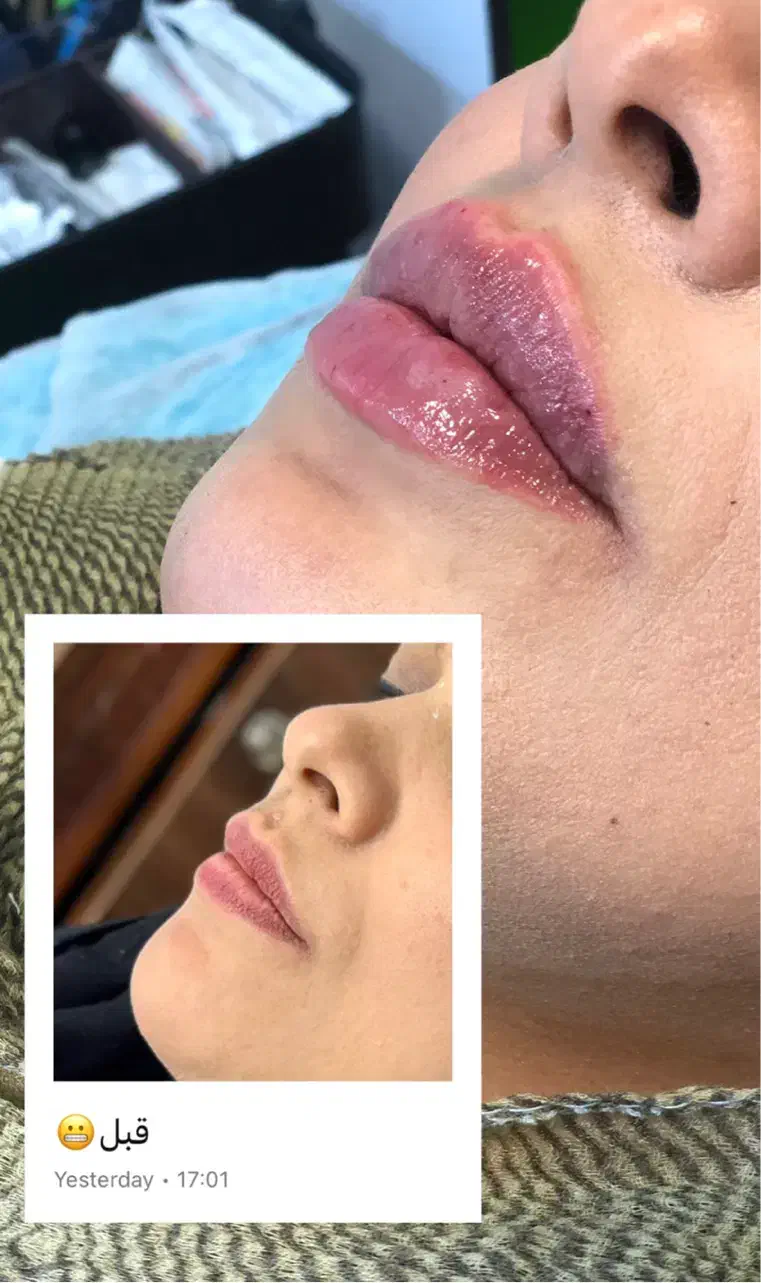 تخفیف ویژه افتتاحیه کلینیک زیبایی|خدمات آرایشگری و زیبایی|اردبیل, |دیوار