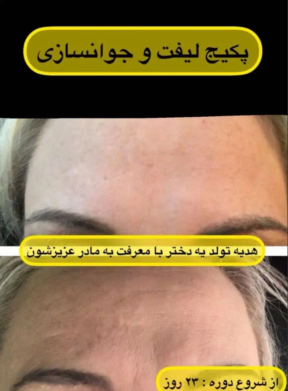 سرم لیفتینگ گاتیو|آرایشی، بهداشتی، درمانی|شیراز, طلاب|دیوار