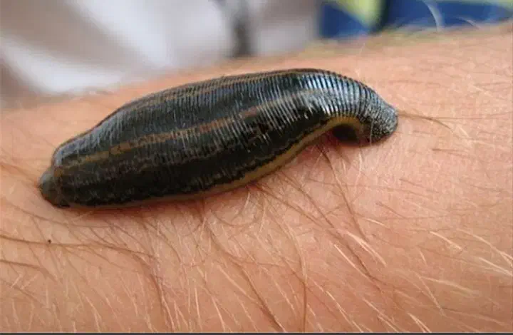 زالو انداختن|آرایشی، بهداشتی، درمانی|نورآباد, |دیوار