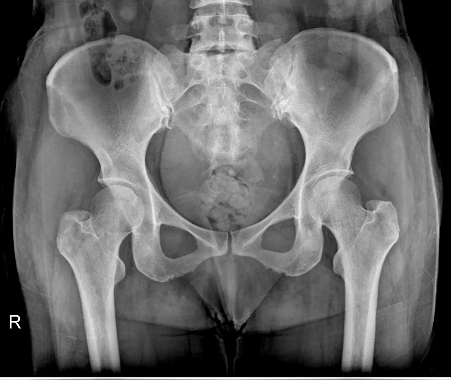 رادیولوژی در منزل آلارا|خدمات آرایشگری و زیبایی|مشهد, احمدآباد|دیوار