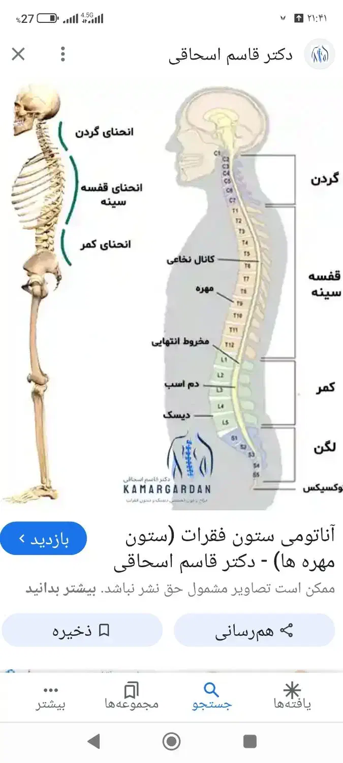 دیسک گردن|پزشکی|سیرجان, |دیوار