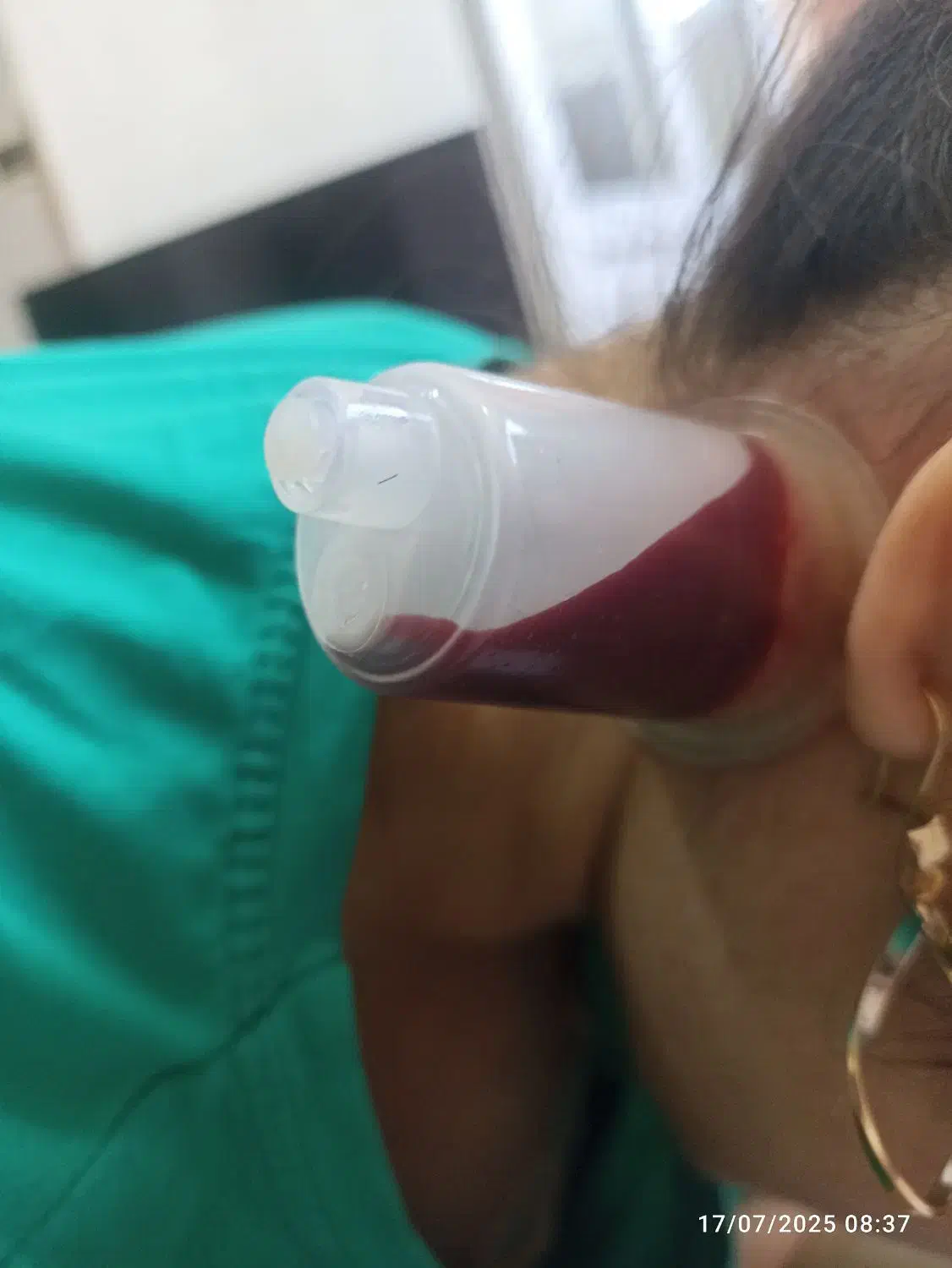 درمان بیماریها با حجامت|خدمات آرایشگری و زیبایی|شوشتر, |دیوار