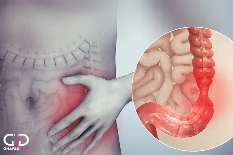 کسی تنبلی روده رو درمان کرده|فعالیت داوطلبانه|بهبهان, |دیوار