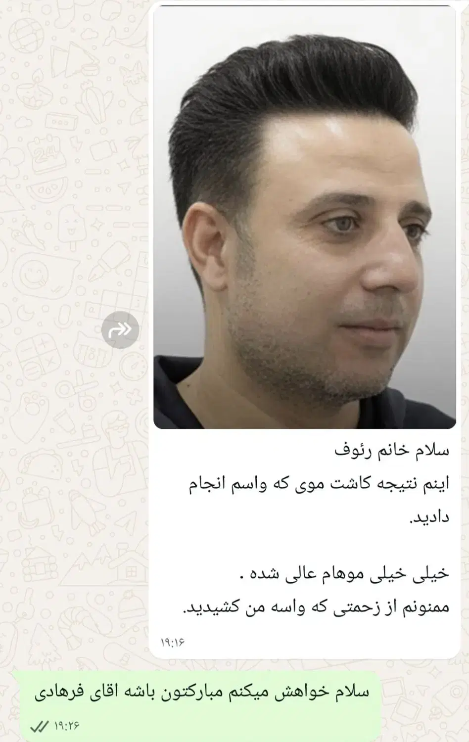 کاشت مو|خدمات آرایشگری و زیبایی|شیراز, قصرالدشت|دیوار