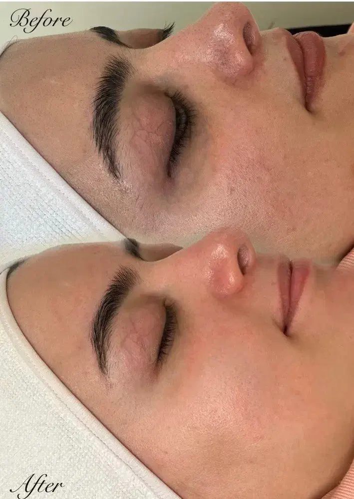 خدمات فشیال(فیشال)پاکسازی دور چشم|خدمات آرایشگری و زیبایی|هشتگرد, هشتگرد قدیم|دیوار