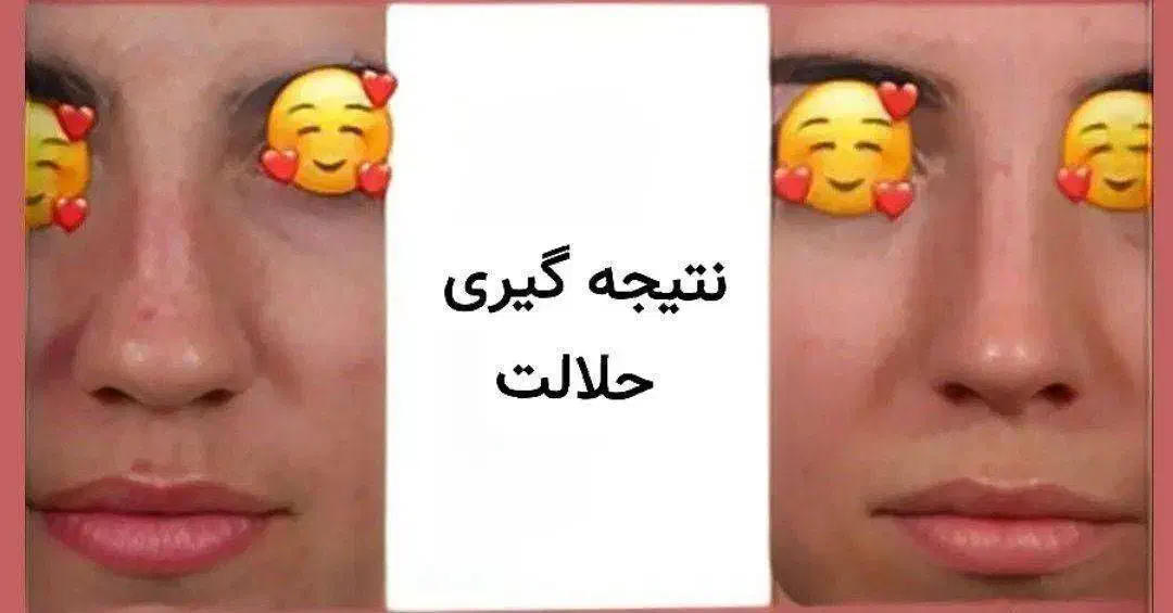 کرم کوچیک کننده بینی|آرایشی، بهداشتی، درمانی|قرقری, |دیوار