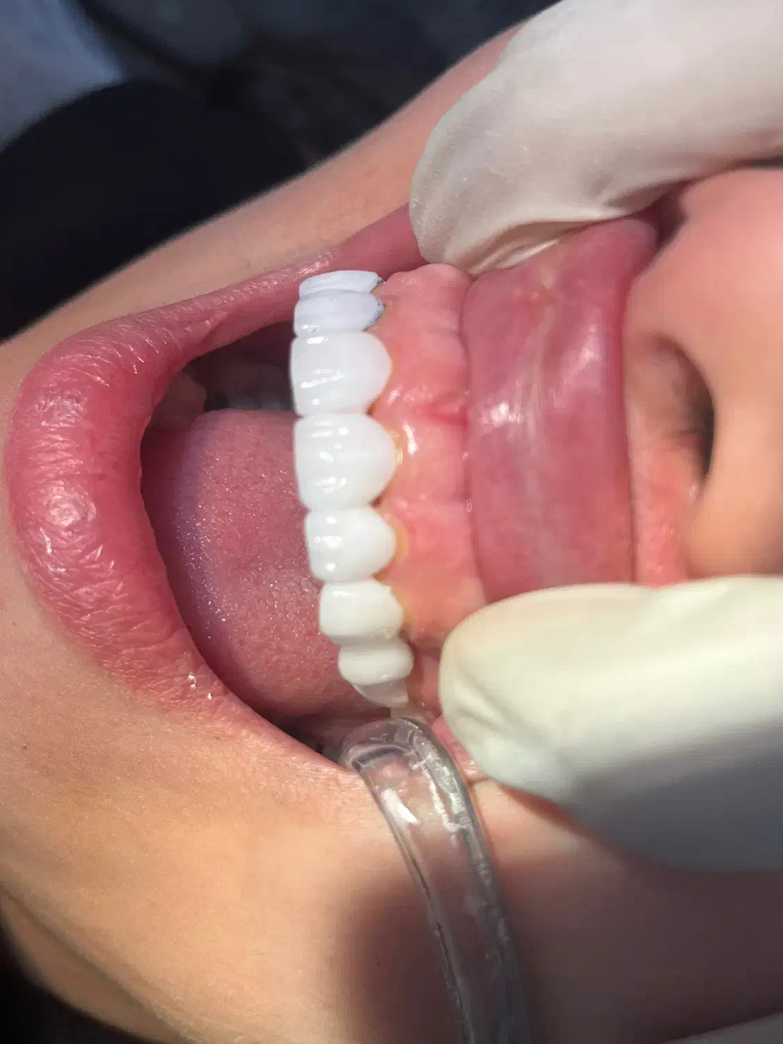 کامپوزیت و لمینیت vip|پزشکی|ساری, |دیوار