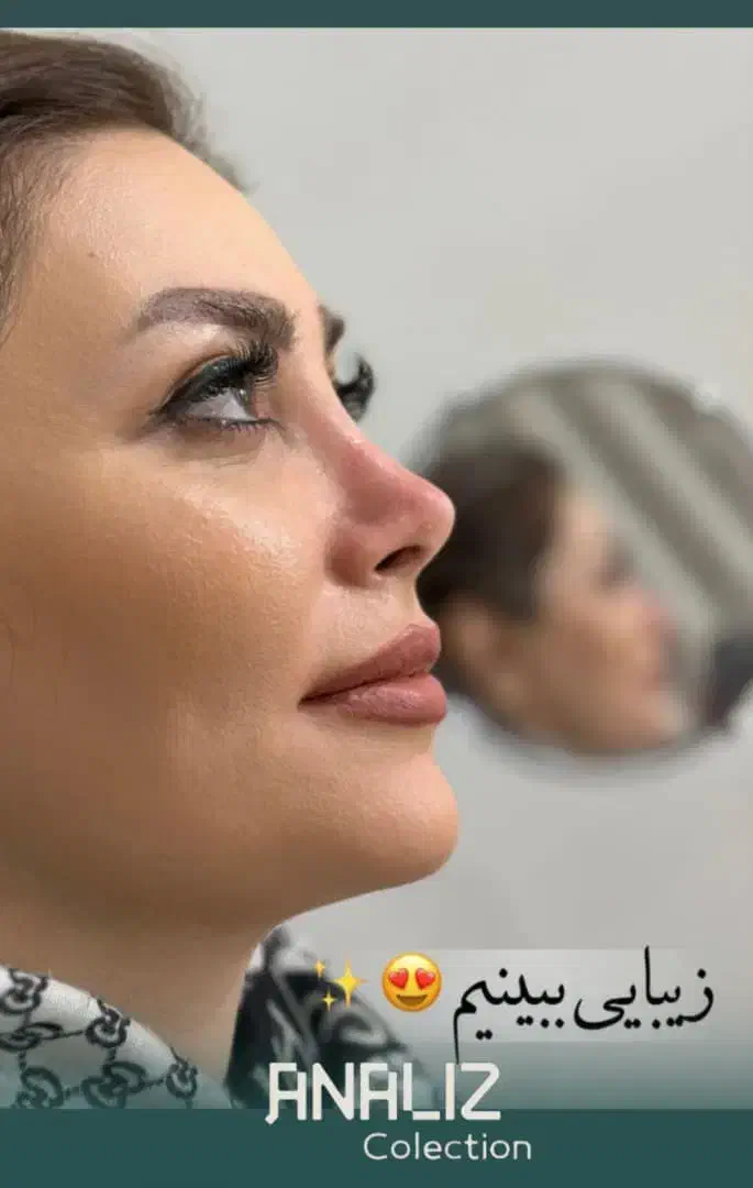 عمل بینی/لیزر co2/پلک/لیپوساکشن/غبغب|خدمات آرایشگری و زیبایی|شیراز, قصرالدشت|دیوار