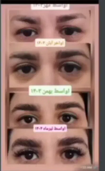 اکسیرپرپشتی مو ،مژه و ابرو|خدمات آرایشگری و زیبایی|گلبهار, شهر جدید گلبهار|دیوار