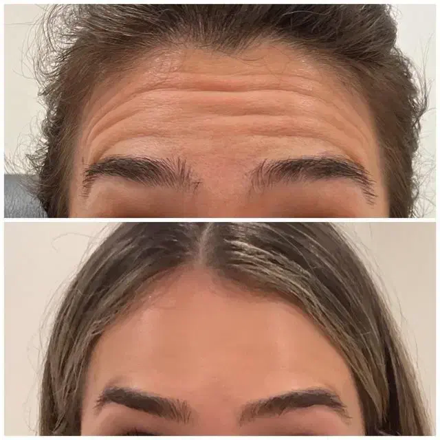 بلک فرایدی کلینیک زیبایی غدیر|خدمات آرایشگری و زیبایی|بروجرد, |دیوار