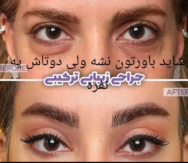 جشنواره پاییزه بلفارو پلاستی درقم|خدمات آرایشگری و زیبایی|قم, بلوار امین و ساحلی|دیوار