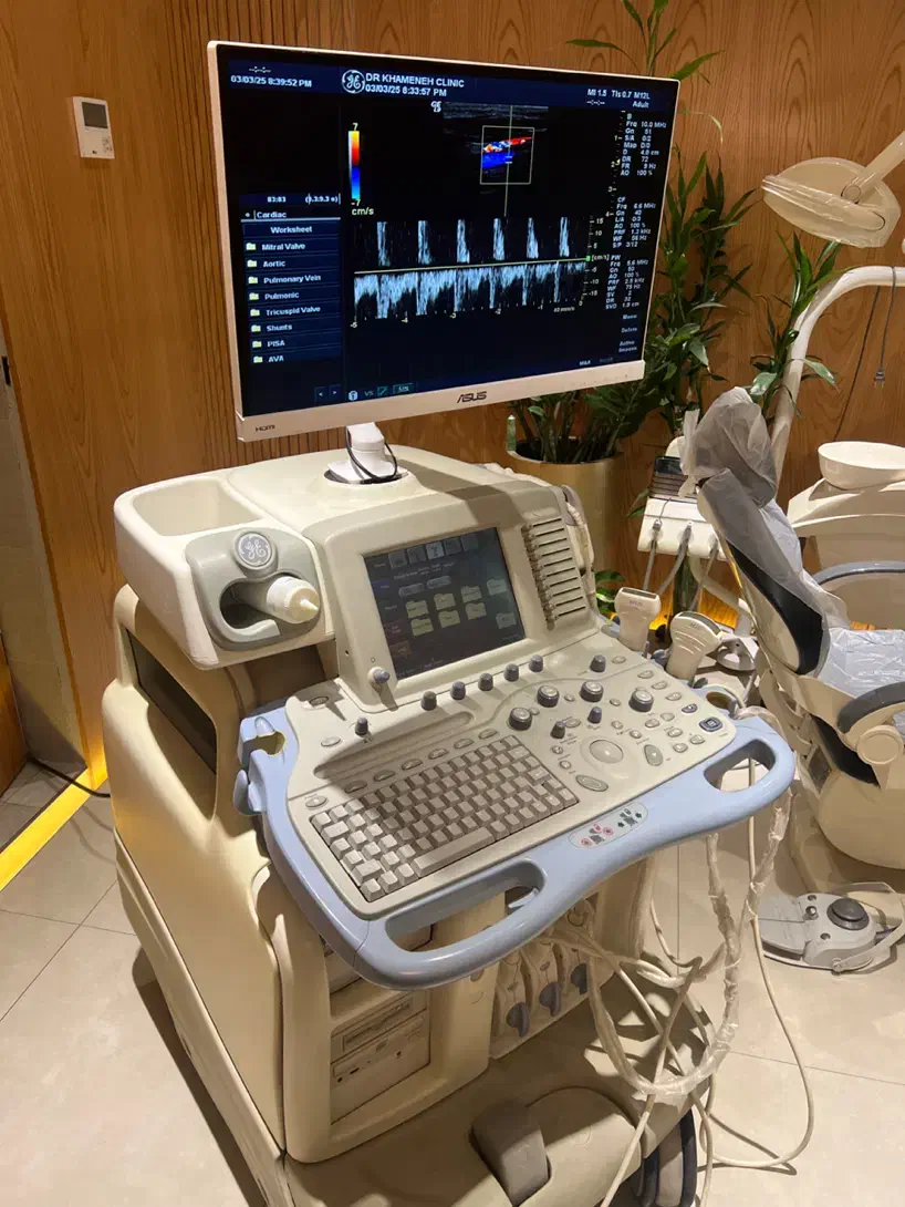 فروش دستگاه سونوگرافی GE آمریکایی|پزشکی|تهران, میرداماد|دیوار