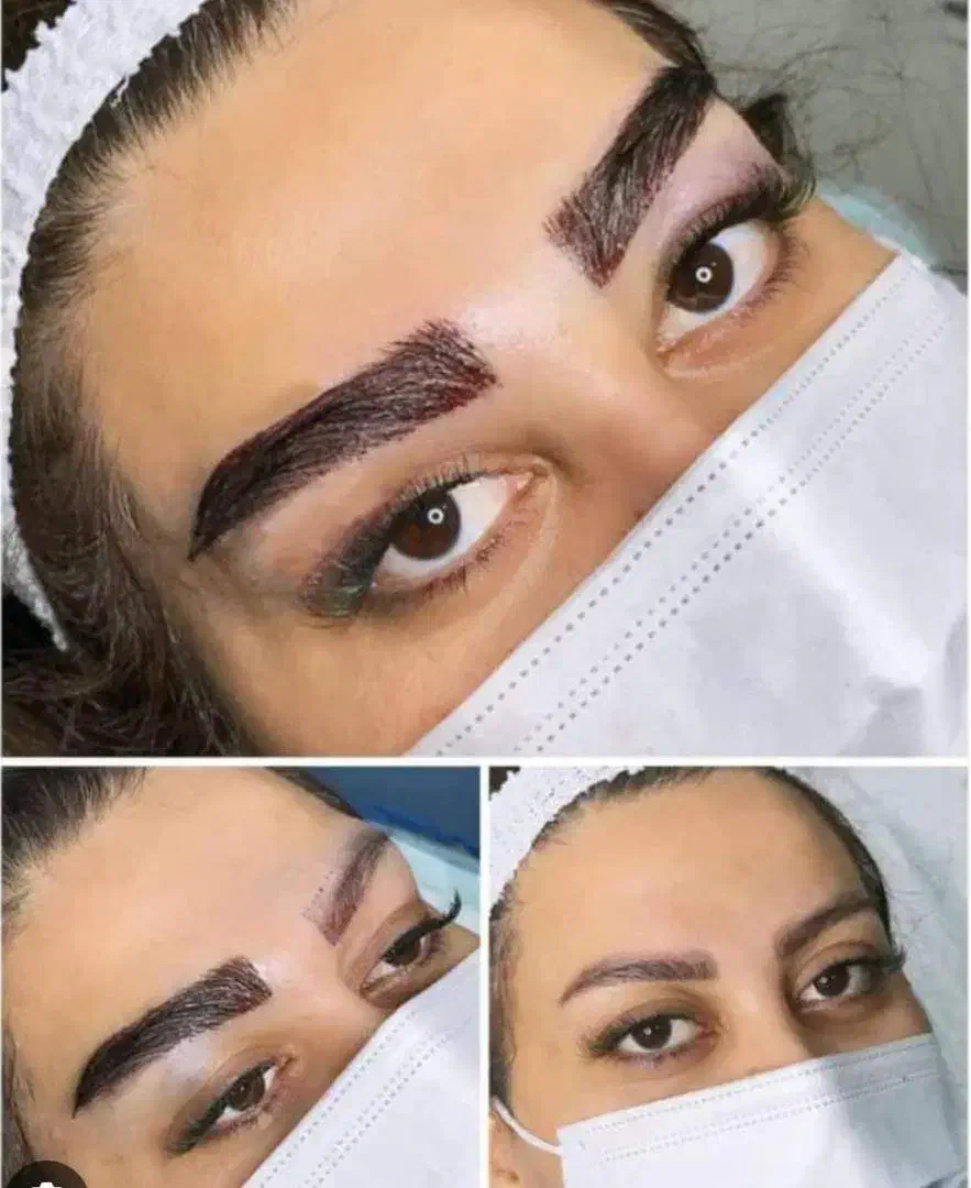 استخدام تکنسین کاشت کار و کات کار|استخدام درمانی، زیبایی، بهداشتی|قم, زنبیل آباد|دیوار