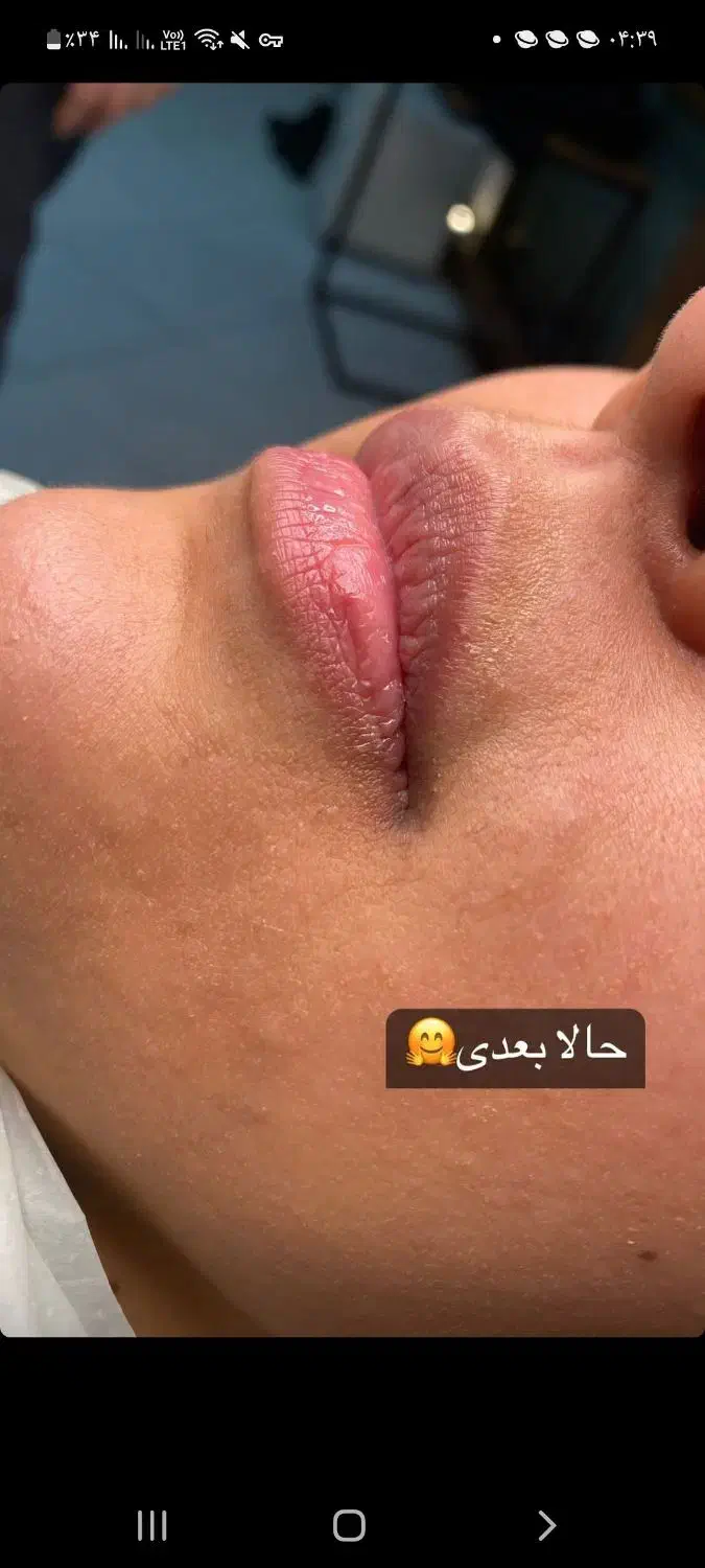 تخفیف یلدایی شیدینگ لب|خدمات آرایشگری و زیبایی|مشهد, شهید رضوی|دیوار