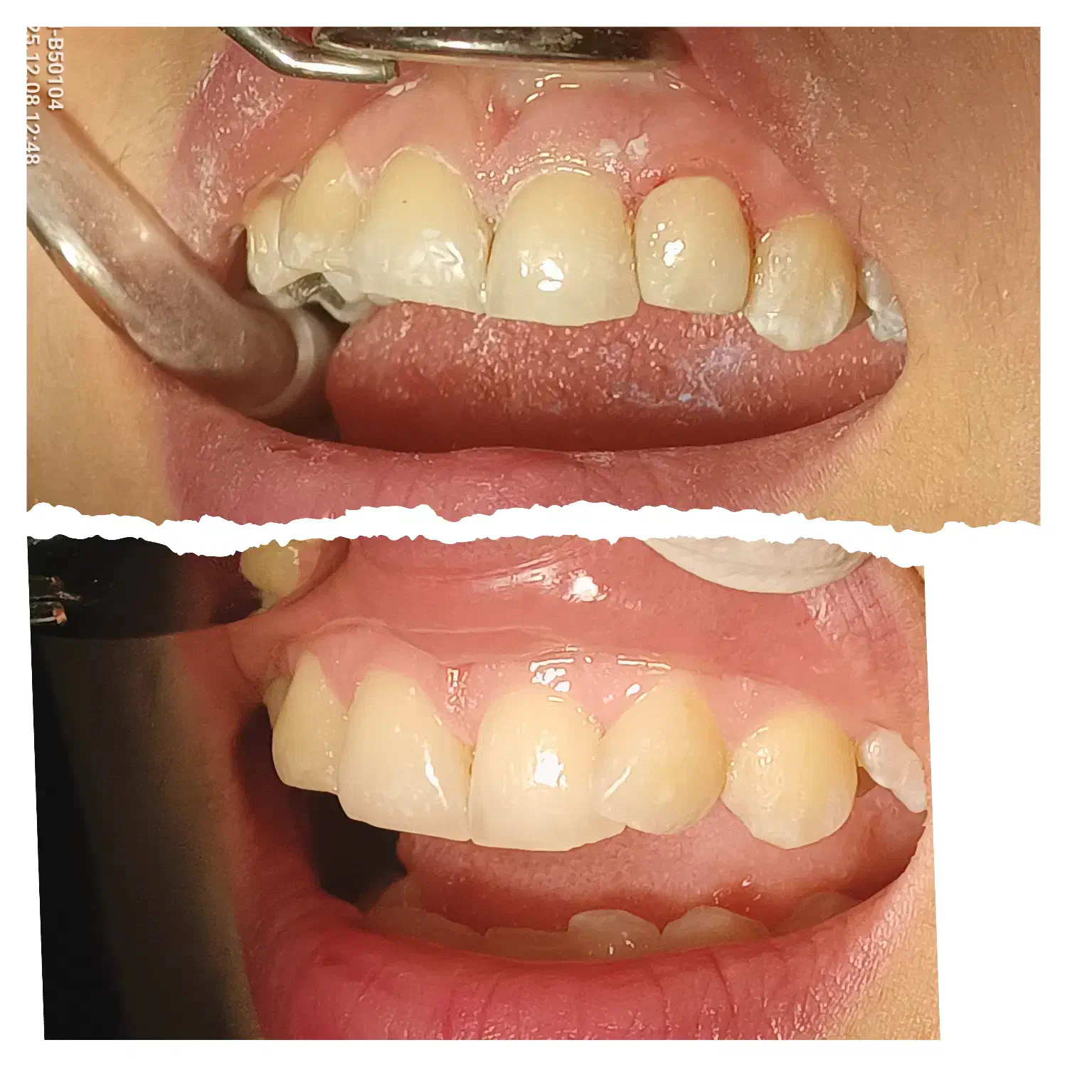 خدمات دندانپزشکی با بهترین کیفیت و پرداخت آسان|خدمات آرایشگری و زیبایی|اقلید, |دیوار