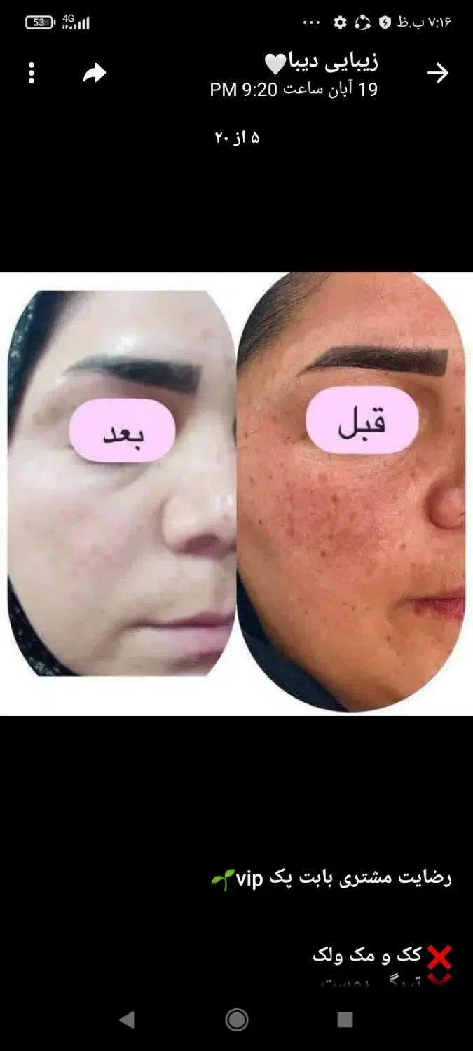 کرم vipاصل تضمینی|آرایشی، بهداشتی، درمانی|یاسوج, |دیوار