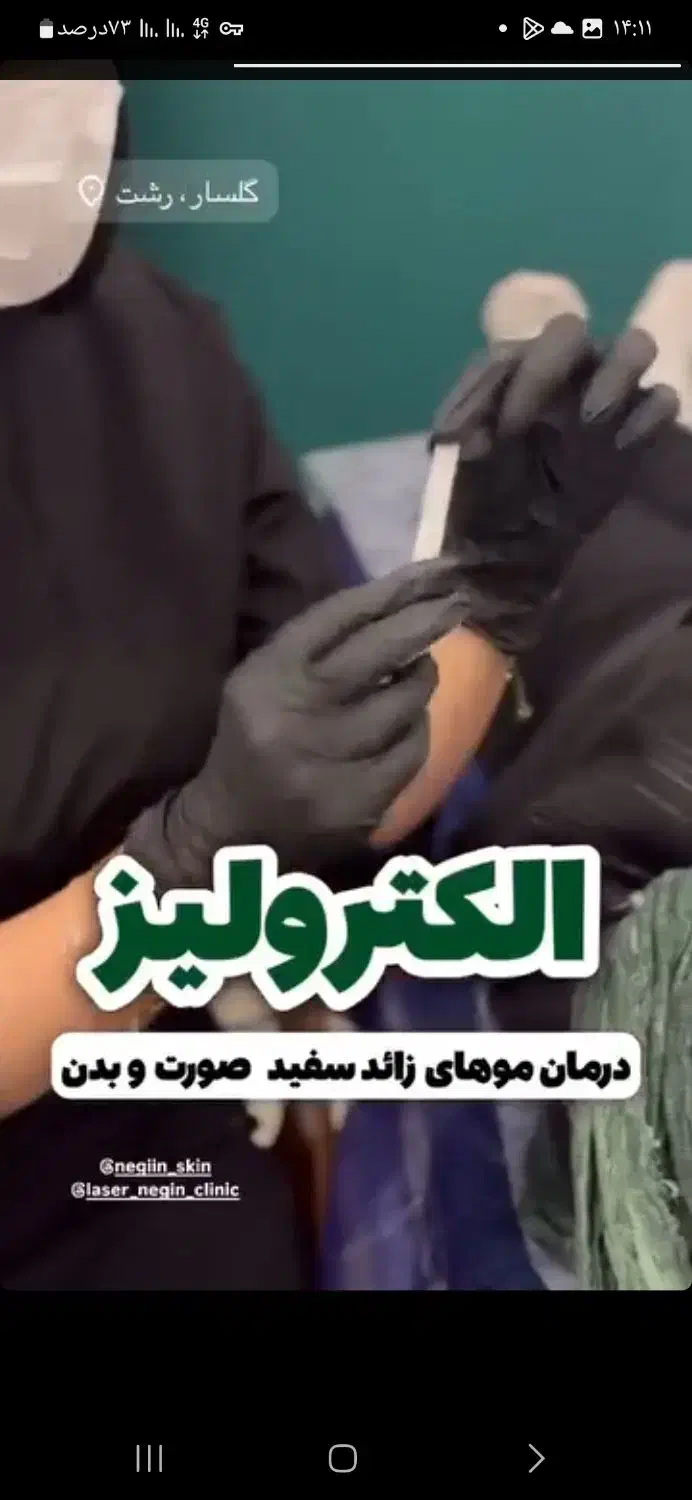 الکترولیز برای همیشه از شر موهای سفید خلاص شوید|آرایشی، بهداشتی، درمانی|ایلام, |دیوار