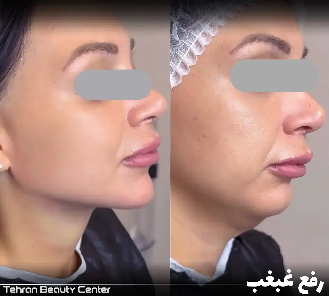 کلینیک/ جراحی بینی / ترمیم / تزریق ژل لب /|خدمات آرایشگری و زیبایی|تهران, سعادتآباد|دیوار