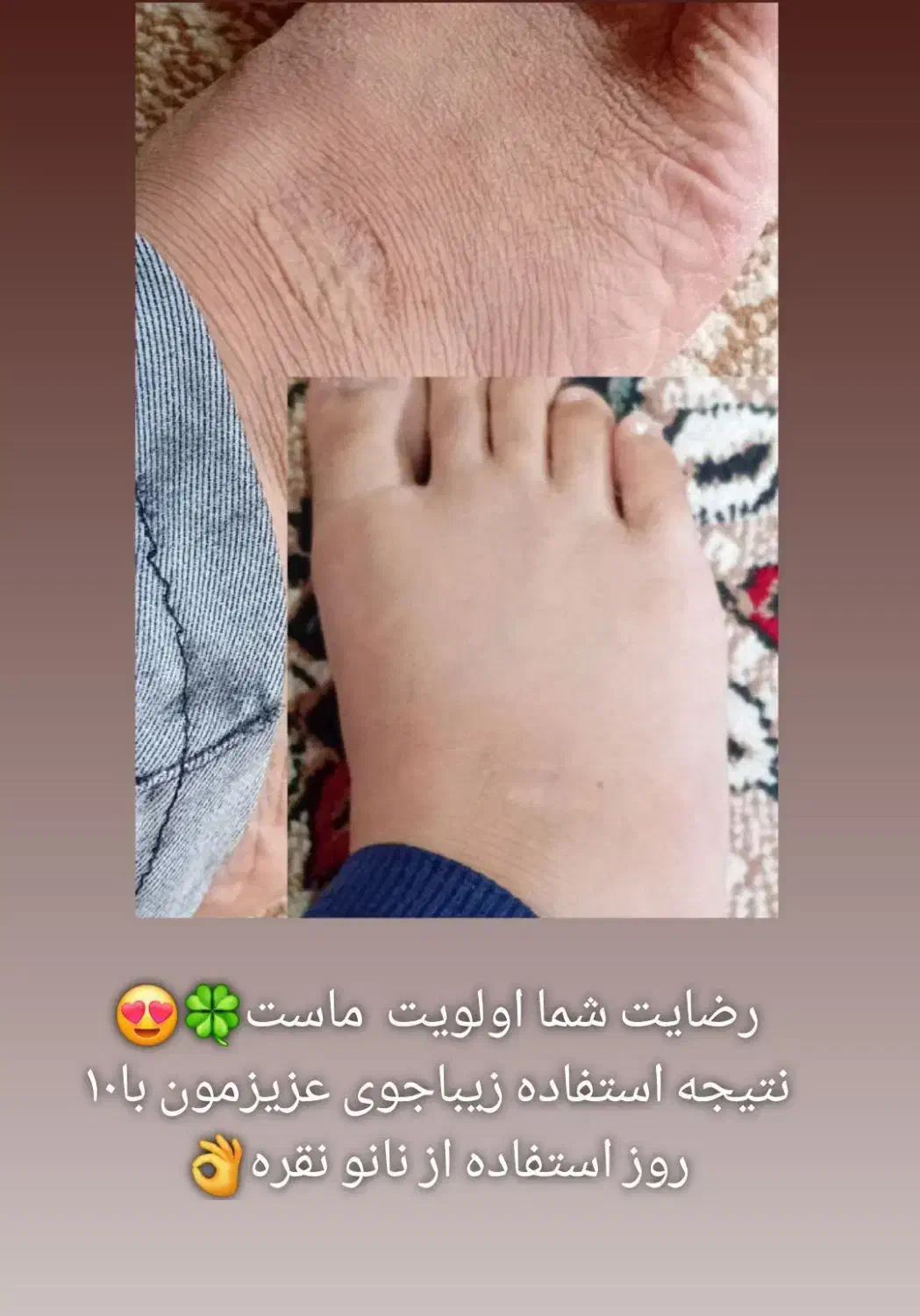 اگه ازترک پوستی رنج میبری پیام بده|فعالیت داوطلبانه|یزد, |دیوار