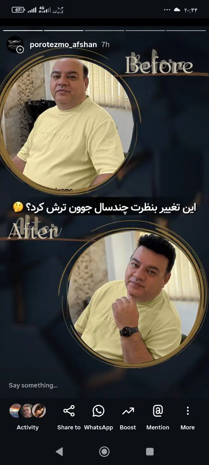 پروتز و ترمیم موی افشان|خدمات آرایشگری و زیبایی|مشهد, کوثر|دیوار