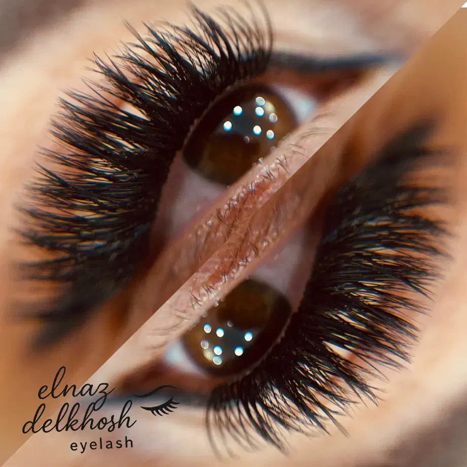 آموزشو خدمات کاشت هیدن|خدمات آرایشگری و زیبایی|رشت, انصاری|دیوار