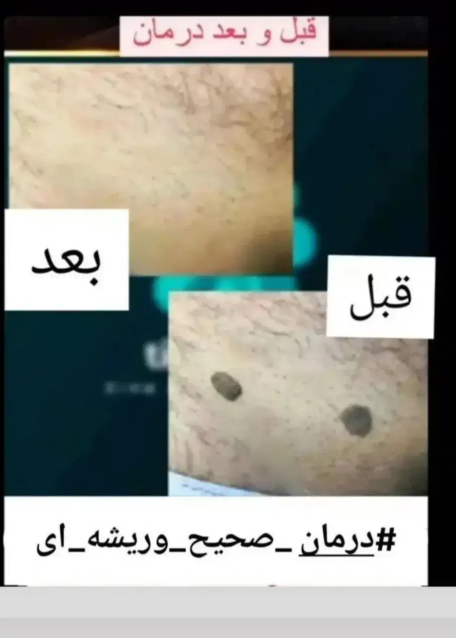 درمان|آرایشی، بهداشتی، درمانی|شهرکرد, |دیوار