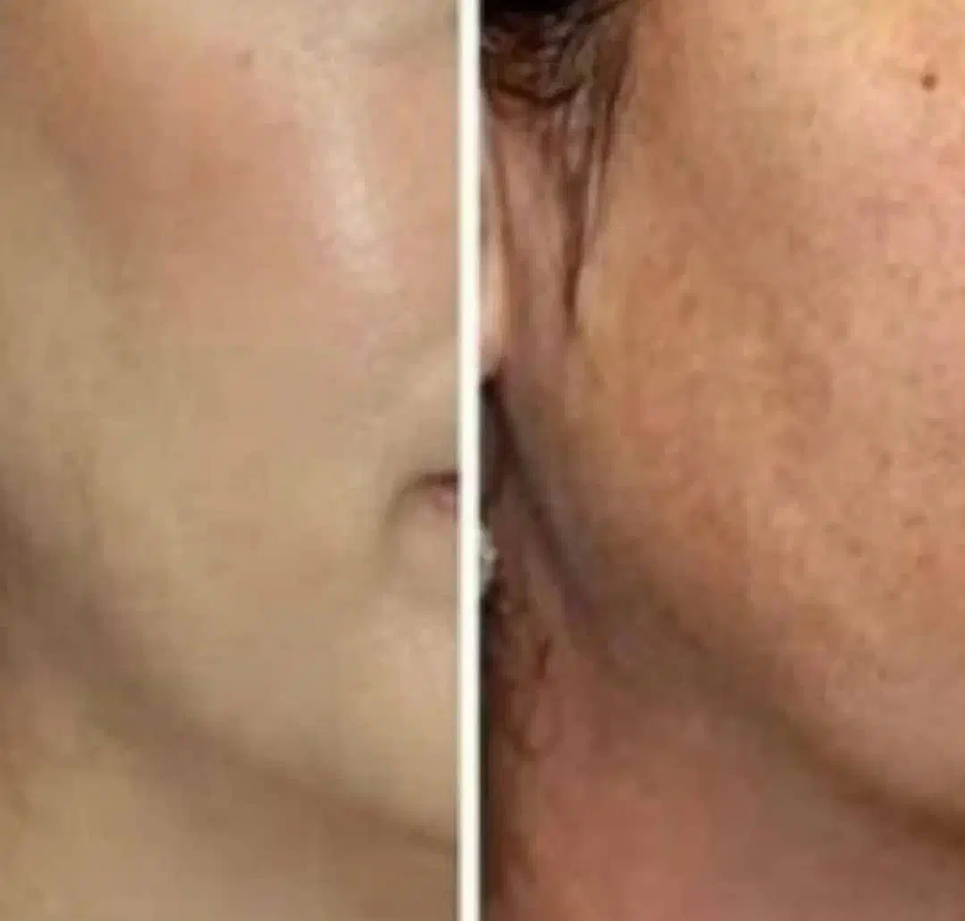 کرم معجزه شب اصل رفع لک وجوش وسفیدشدن پوست|آرایشی، بهداشتی، درمانی|قم, چهار مردان|دیوار