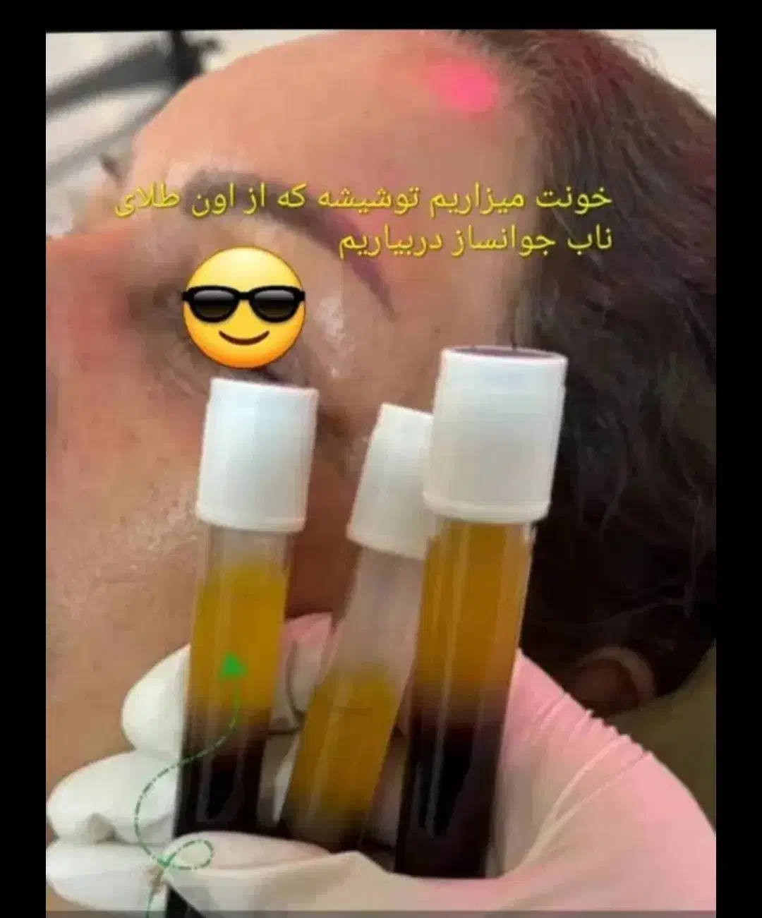 جشنواره تخفیف ویژه تزریق ژل و بوتاکس|خدمات آرایشگری و زیبایی|اصفهان, بوستان آینه خانه|دیوار
