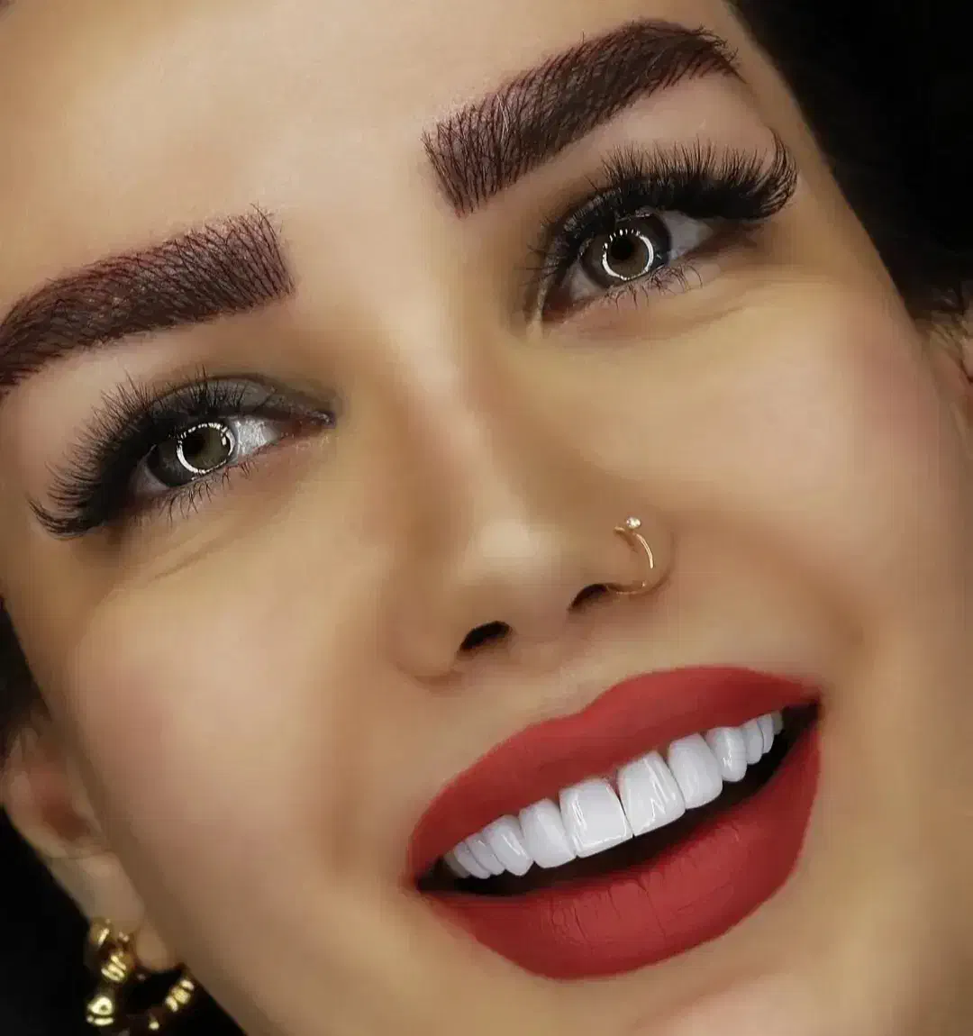 کامپوزیت دندان|خدمات آرایشگری و زیبایی|پرند, فاز ۶|دیوار