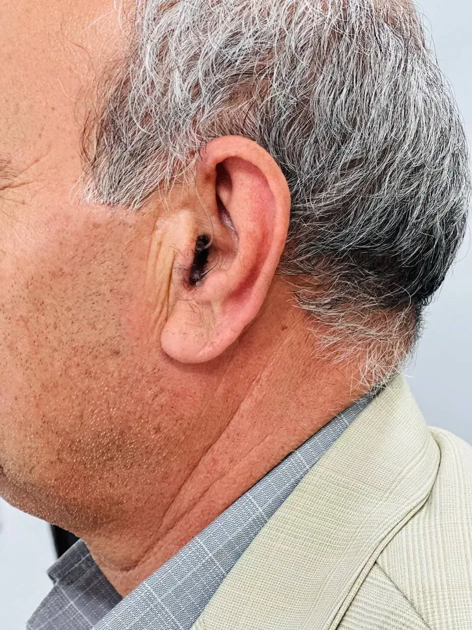 تجویز انواع سمعک های نامرئی و هوشمند روز دنیا|پزشکی|بوکان, |دیوار