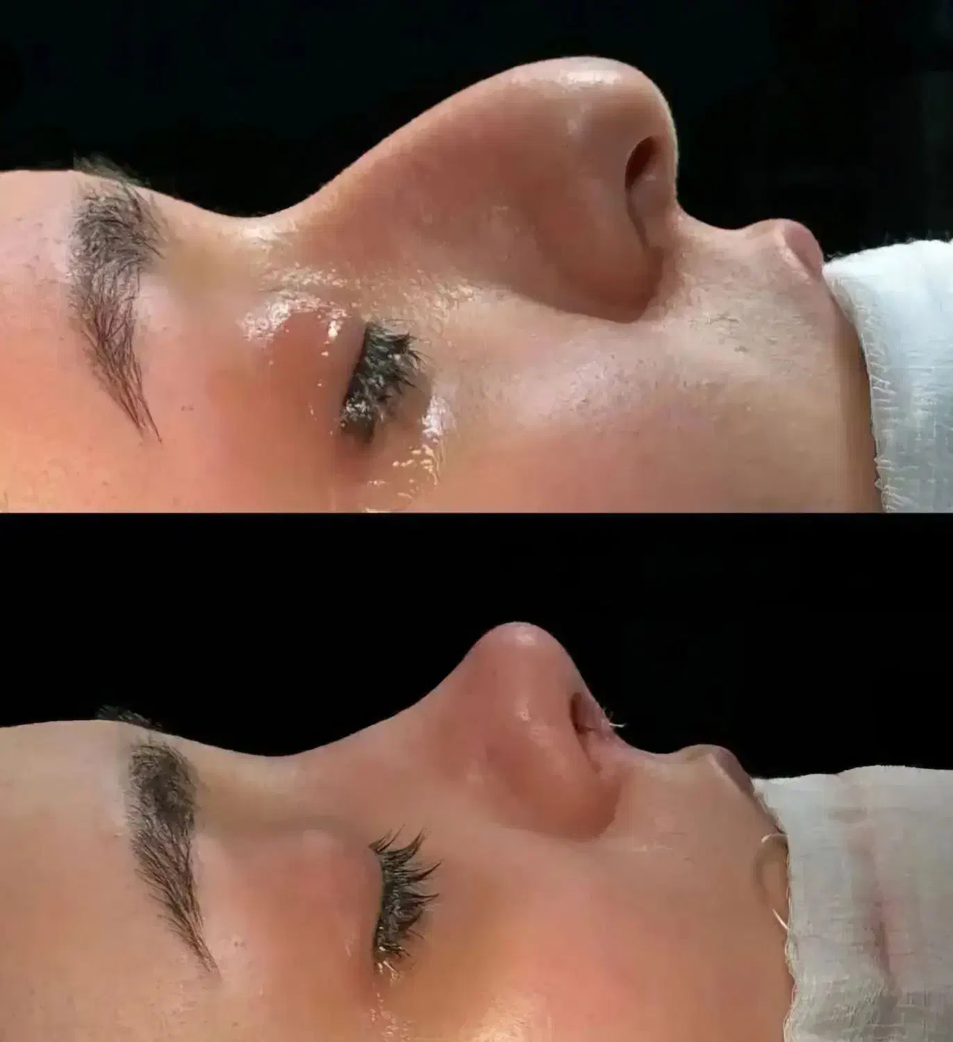 عمل زیبایی بینی در تهران با فوق تخصص نقد و اقساط|خدمات آرایشگری و زیبایی|اصفهان, فرح آباد|دیوار