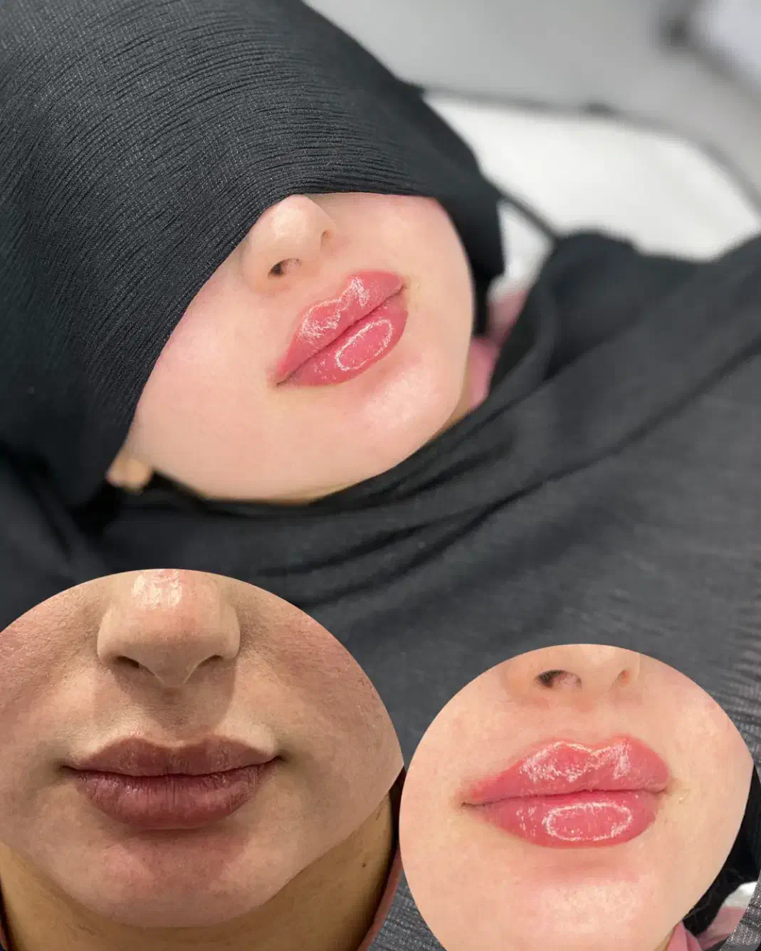 ژل و بوتاکس|خدمات آرایشگری و زیبایی|شوشتر, |دیوار