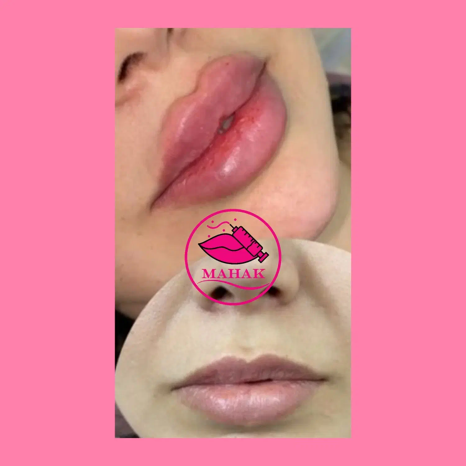 آموزش وخدمات شیدینگ لب بن مژه ژل بوتاکس پرسینگ|خدمات آرایشگری و زیبایی|قم, شهرک قدس|دیوار