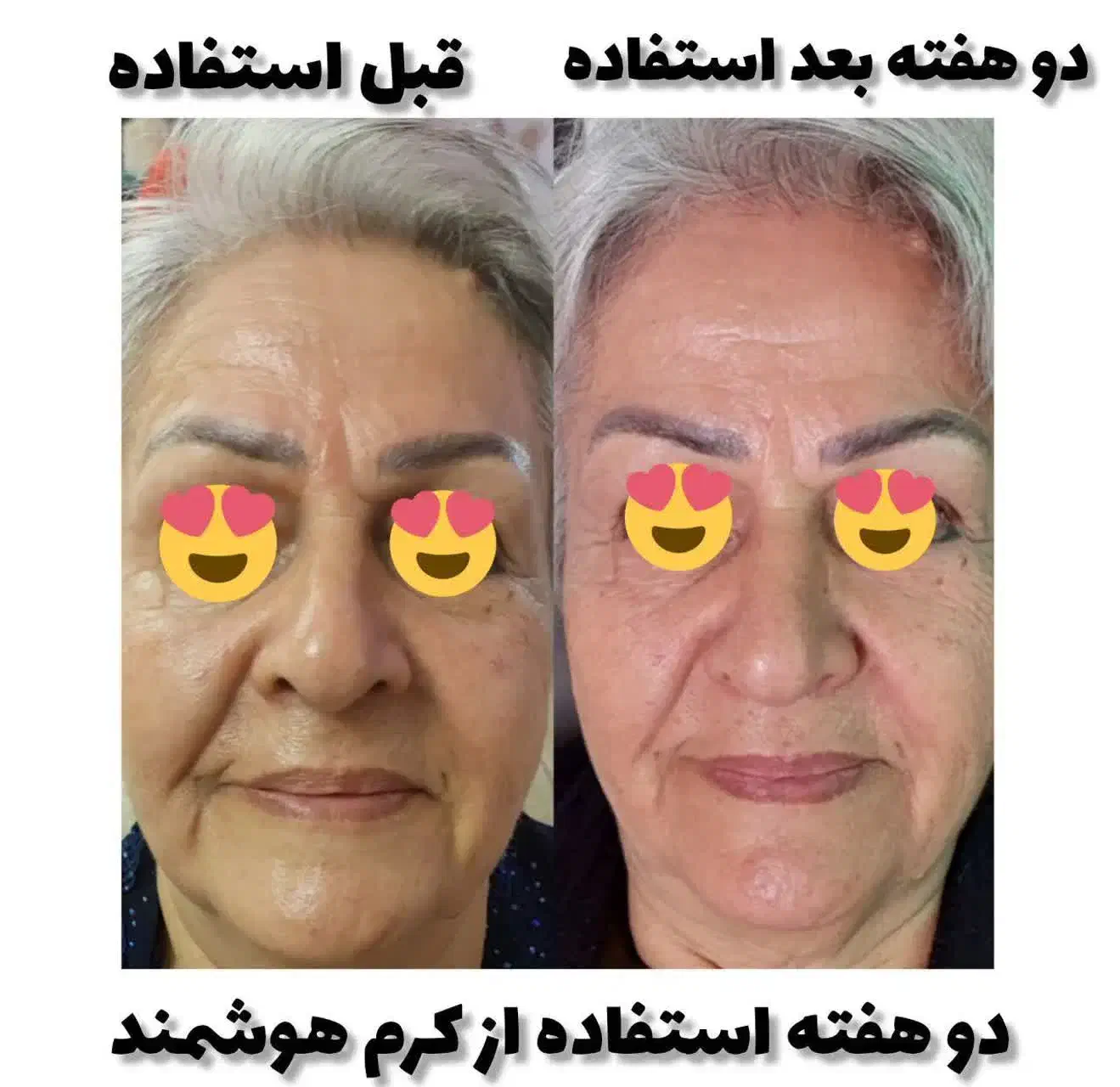 متخصص پوست و موهمراه مشاوره‌  وروتین پیشنهاد محصول|خدمات آرایشگری و زیبایی|اردبیل, |دیوار